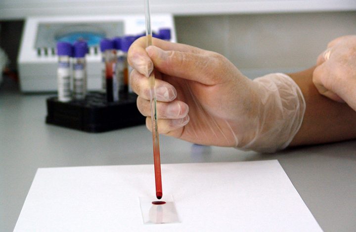 Casal que recebeu falso resultado positivo de HIV deve ser indenizado em 15 mil