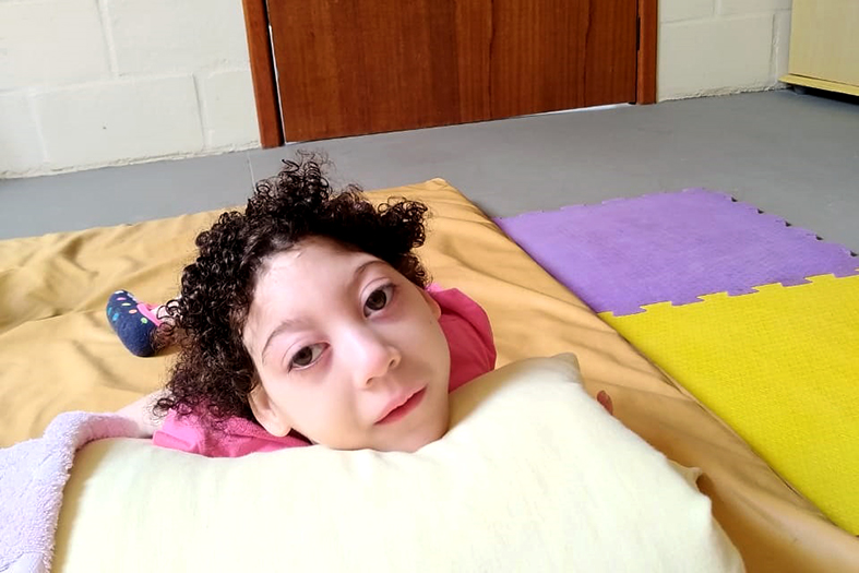 menina com microcefalia olha para a câmera