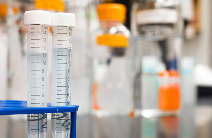 Motorista deve ser indenizado após exame toxicológico apresentar resultado equivocado