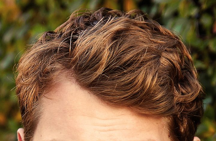 Negada indenização a consumidor que teve reação alérgica a tonalizante de cabelo