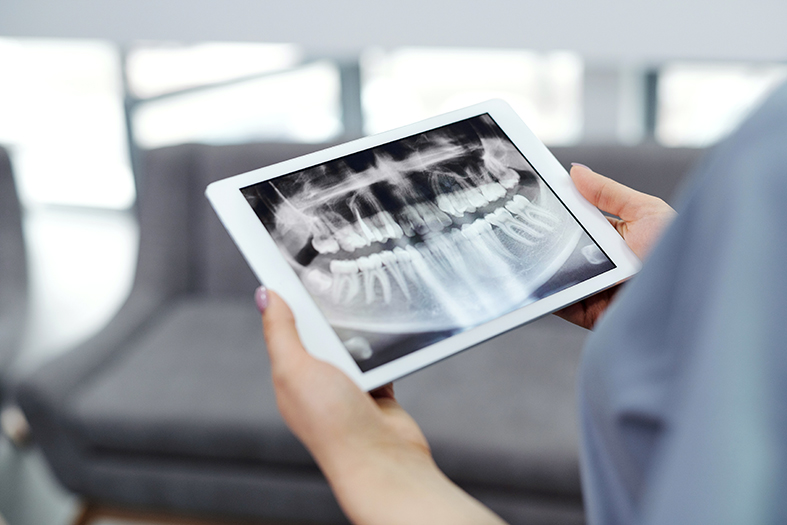 Dentista segura tablet com imagem de radiografia da arcada dentária de um paciente.