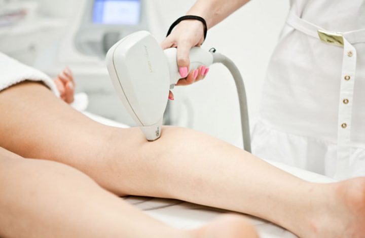 Empresa deve indenizar cliente que sofreu queimadura em aplicação a laser