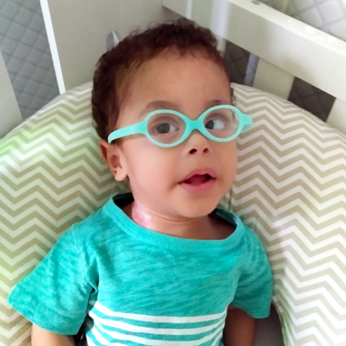 Bebê com Síndrome de Down olha para a câmera. Sua pele é branca, seus cabelos da cor preta e ele usa óculos de grau com armação na cor verde esmeralda combinando com sua roupa.