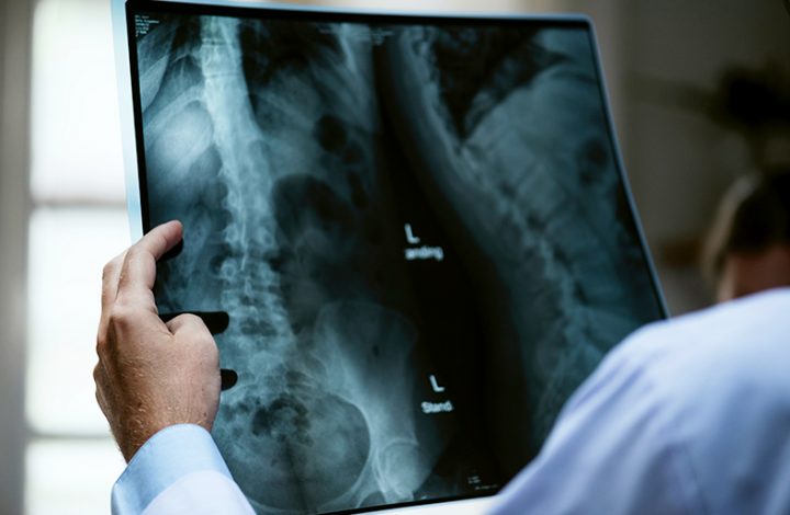 Justiça nega indenização a família de criança nascida com problemas congênitos não diagnosticados