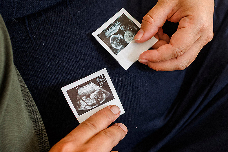 detalhe de duas mãos, uma masculina e outra feminina, segurando, cada uma, uma imagem de ultrassonografia, em formato de polaroide, de um feto.